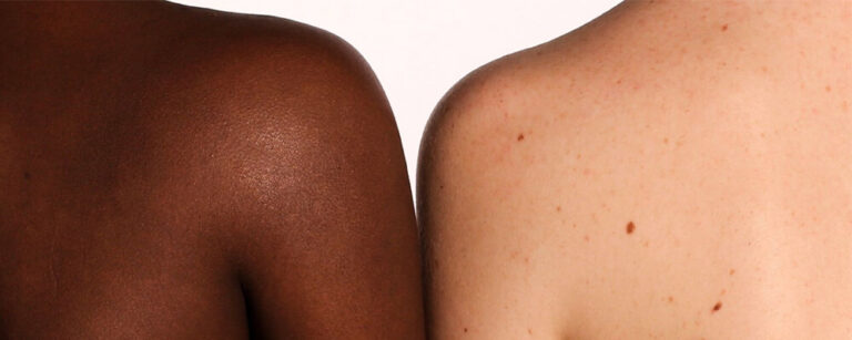 Difference between Prejudice Racism and Discrimination