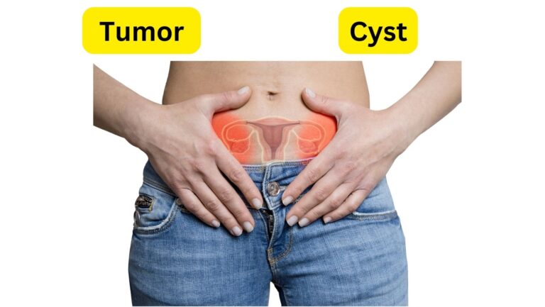 Difference between Tumor and Cyst